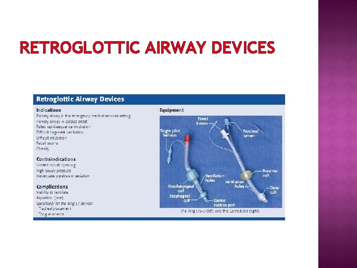 RETROGLOTTIC AIRWAY DEVICES 