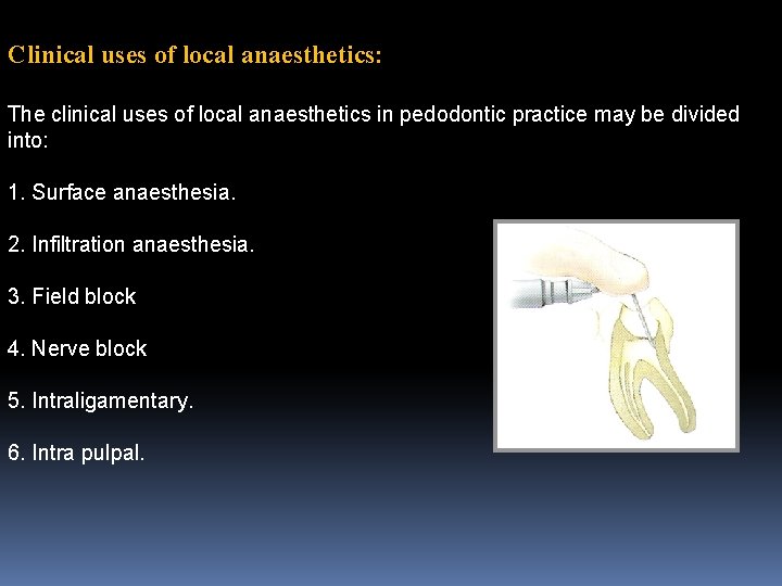 Clinical uses of local anaesthetics: The clinical uses of local anaesthetics in pedodontic practice