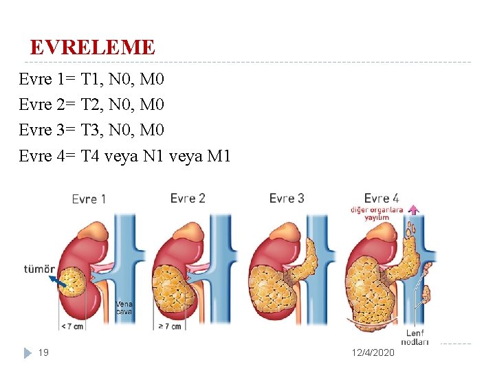 EVRELEME Evre 1= T 1, N 0, M 0 Evre 2= T 2, N