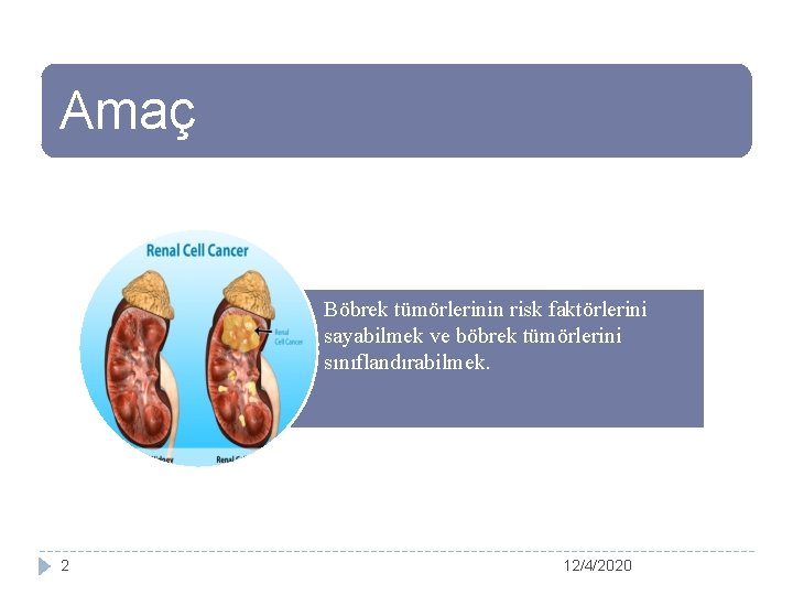 Amaç Böbrek tümörlerinin risk faktörlerini sayabilmek ve böbrek tümörlerini sınıflandırabilmek. 2 12/4/2020 