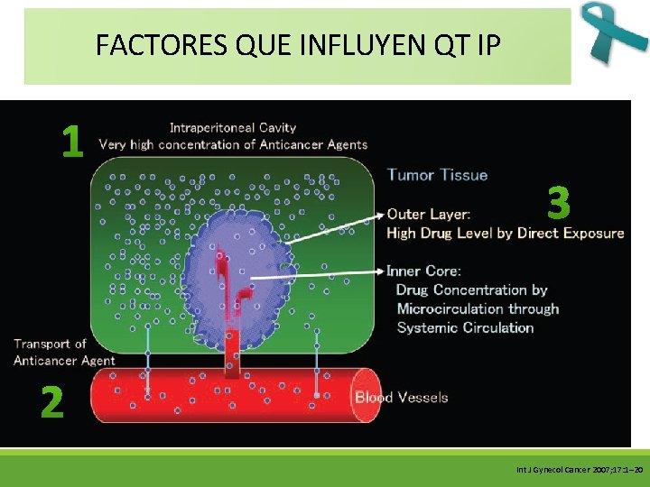 FACTORES QUE INFLUYEN QT IP 1 3 2 Int J Gynecol Cancer 2007; 17: