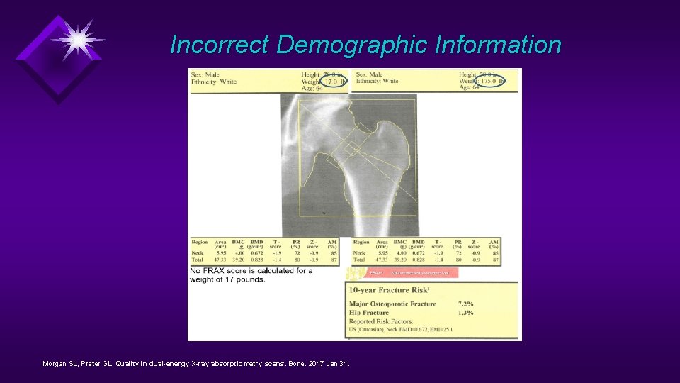 Incorrect Demographic Information Morgan SL, Prater GL. Quality in dual-energy X-ray absorptiometry scans. Bone.