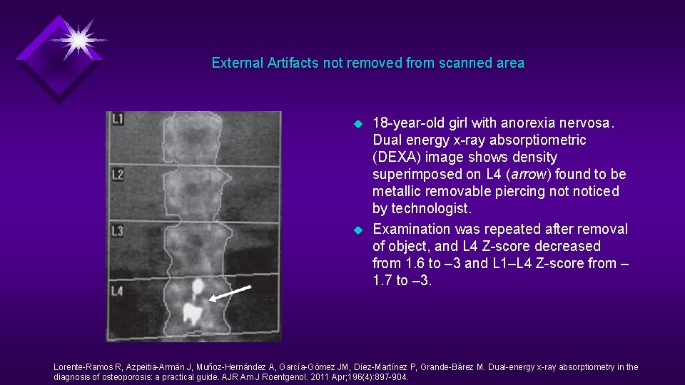 External Artifacts not removed from scanned area u u 18 -year-old girl with anorexia