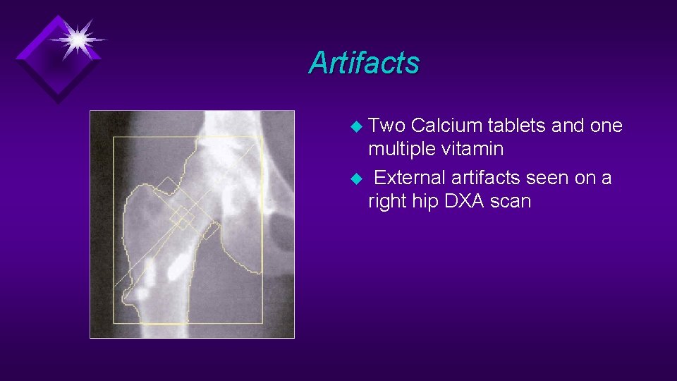 Artifacts u Two Calcium tablets and one multiple vitamin u External artifacts seen on