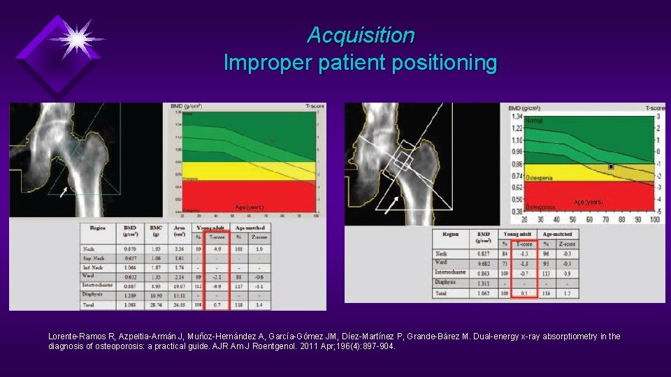 Acquisition Improper patient positioning Lorente-Ramos R, Azpeitia-Armán J, Muñoz-Hernández A, García-Gómez JM, Díez-Martínez P,