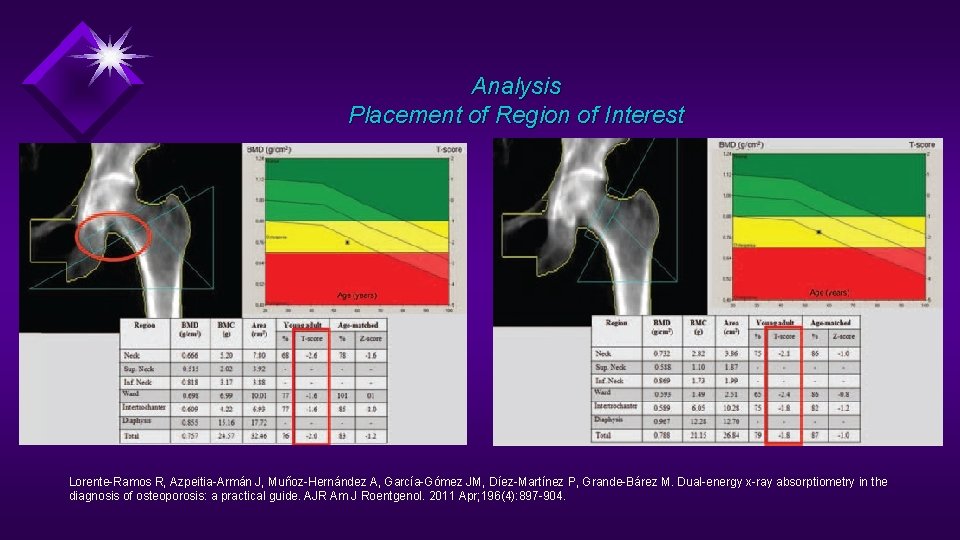 Analysis Placement of Region of Interest Lorente-Ramos R, Azpeitia-Armán J, Muñoz-Hernández A, García-Gómez JM,