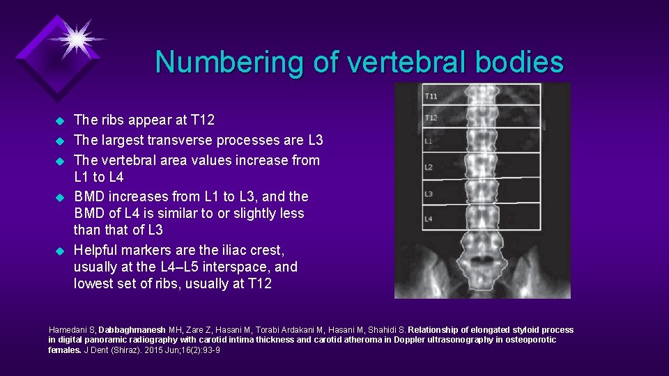 Numbering of vertebral bodies u u u The ribs appear at T 12 The