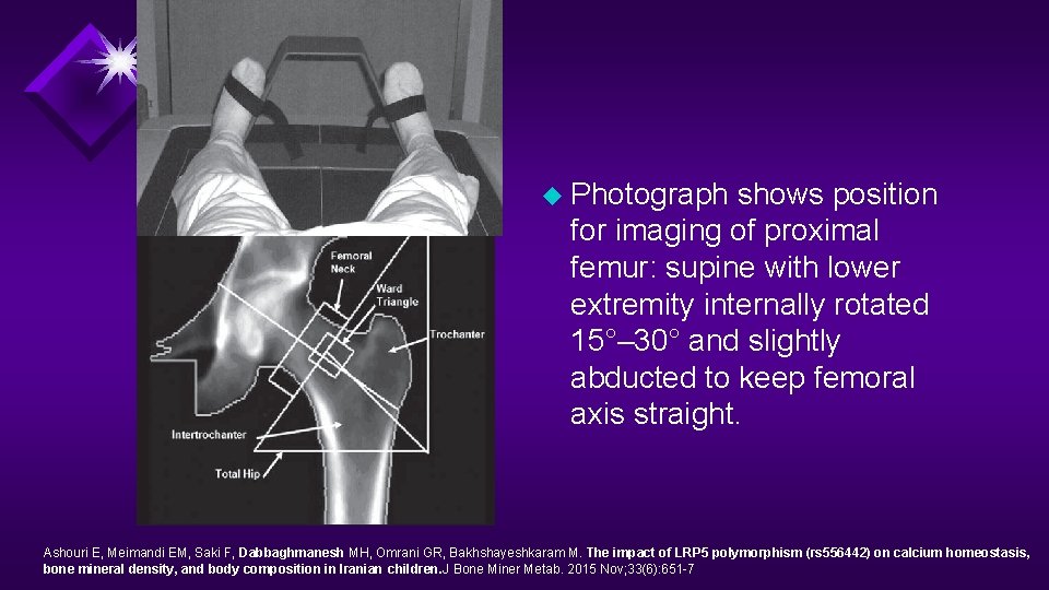 u Photograph shows position for imaging of proximal femur: supine with lower extremity internally