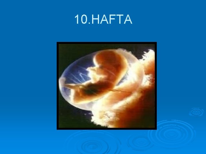 10. HAFTA 