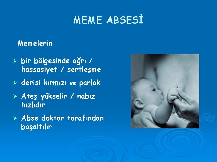 MEME ABSESİ Memelerin Ø bir bölgesinde ağrı / hassasiyet / sertleşme Ø derisi kırmızı