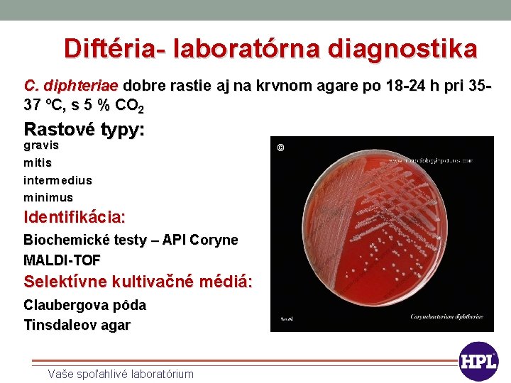 Diftéria- laboratórna diagnostika C. diphteriae dobre rastie aj na krvnom agare po 18 -24