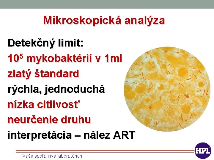 Mikroskopická analýza Detekčný limit: 105 mykobaktérií v 1 ml zlatý štandard rýchla, jednoduchá nízka