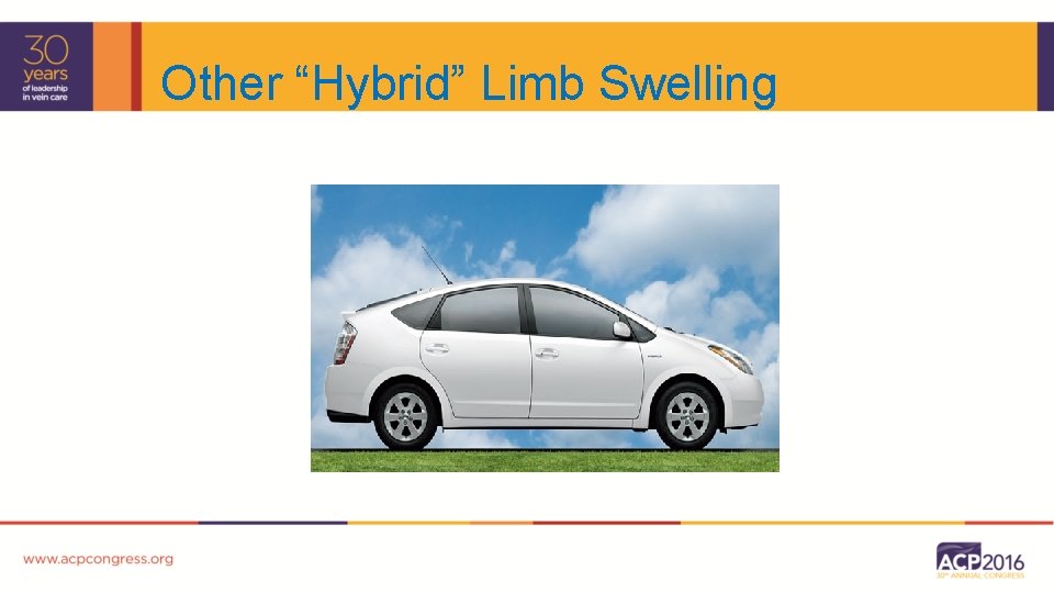 Other “Hybrid” Limb Swelling 