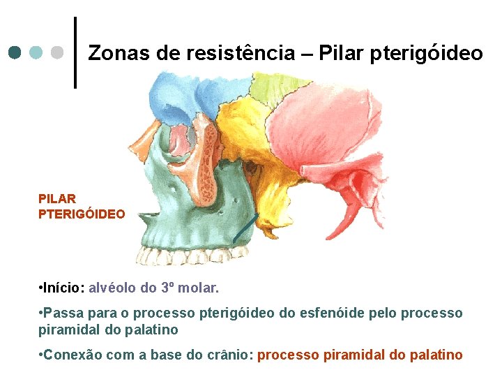 Zonas de resistência – Pilar pterigóideo PILAR PTERIGÓIDEO • Início: alvéolo do 3º molar.