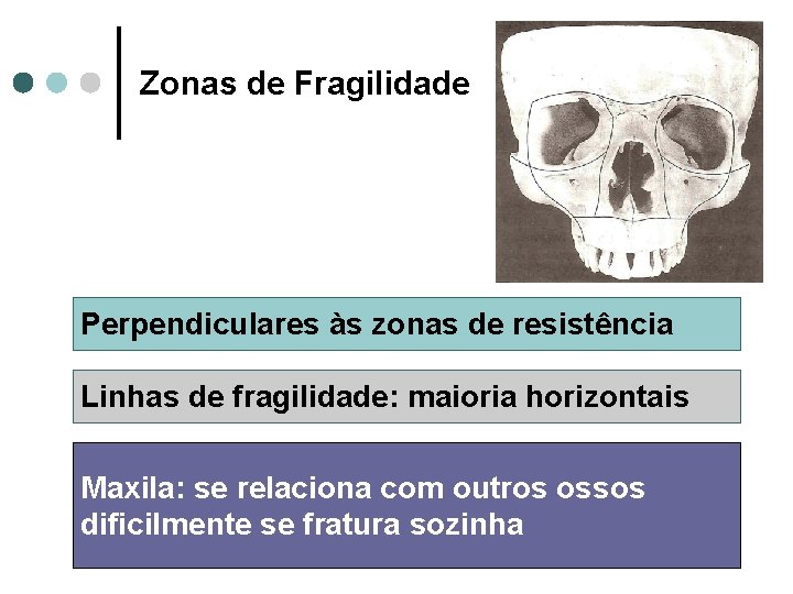 Zonas de Fragilidade Perpendiculares às zonas de resistência Linhas de fragilidade: maioria horizontais Maxila: