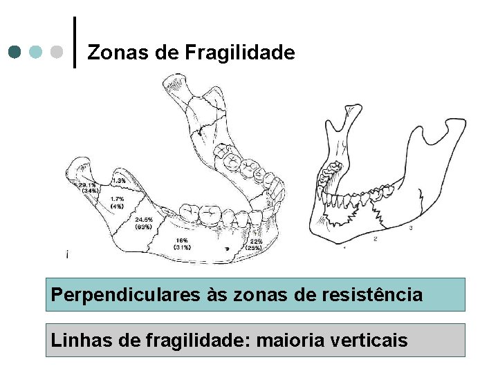 Zonas de Fragilidade Perpendiculares às zonas de resistência Linhas de fragilidade: maioria verticais 