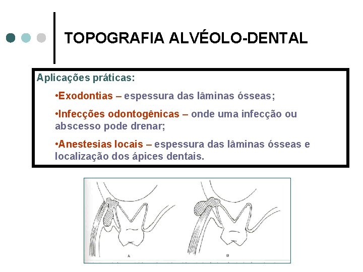 TOPOGRAFIA ALVÉOLO-DENTAL Aplicações práticas: • Exodontias – espessura das lâminas ósseas; • Infecções odontogênicas