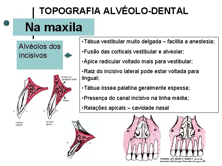 TOPOGRAFIA ALVÉOLO-DENTAL Na maxila Alvéolos dos incisivos • Tábua vestibular muito delgada – facilita