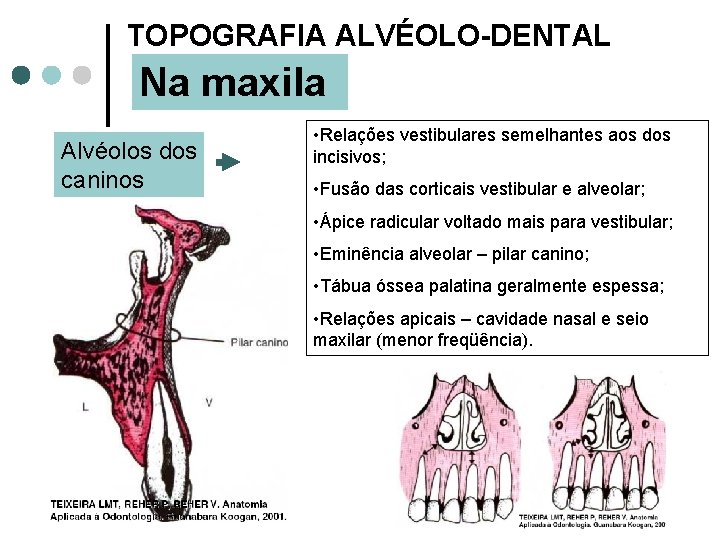 TOPOGRAFIA ALVÉOLO-DENTAL Na maxila Alvéolos dos caninos • Relações vestibulares semelhantes aos dos incisivos;