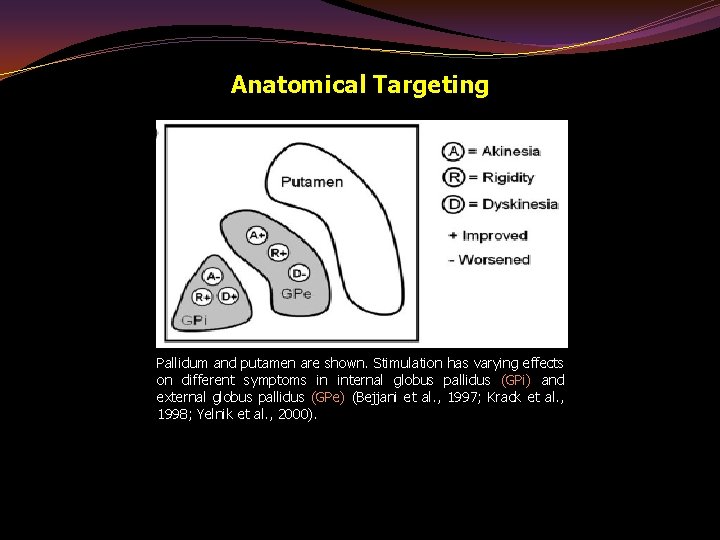 Anatomical Targeting Pallidum and putamen are shown. Stimulation has varying effects on different symptoms