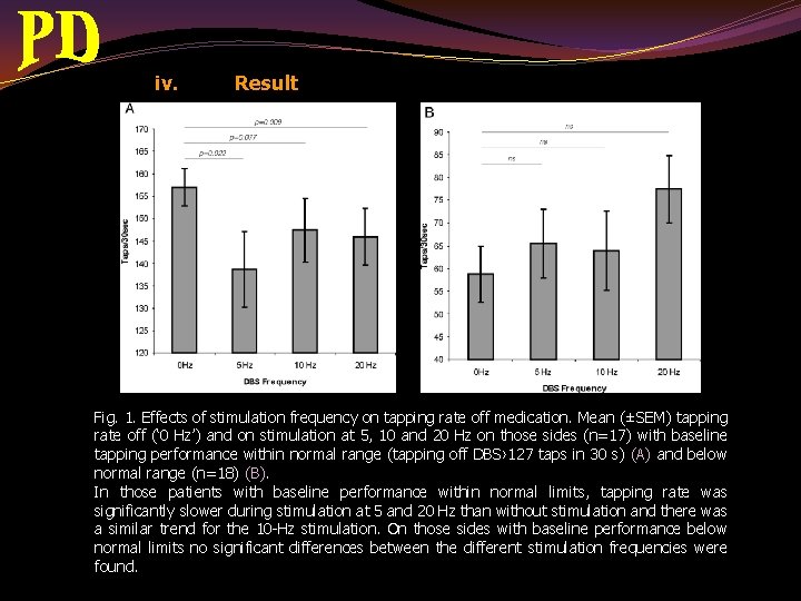 iv. Result Fig. 1. Effects of stimulation frequency on tapping rate off medication. Mean