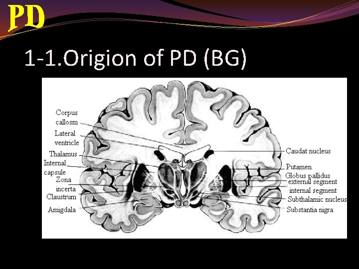 1 -1. Origion of PD (BG) 