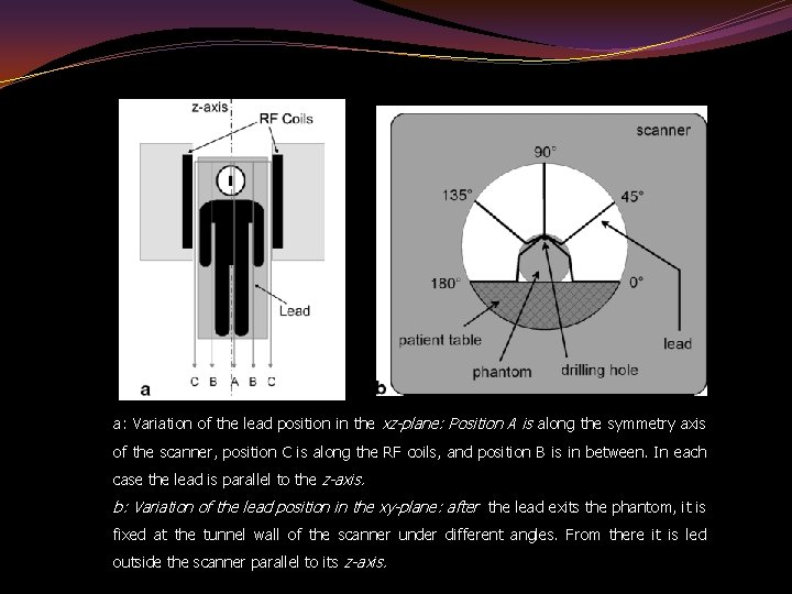 a: Variation of the lead position in the xz-plane: Position A is along the