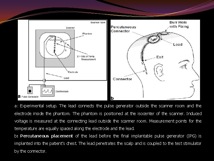 a: Experimental setup. The lead connects the pulse generator outside the scanner room and