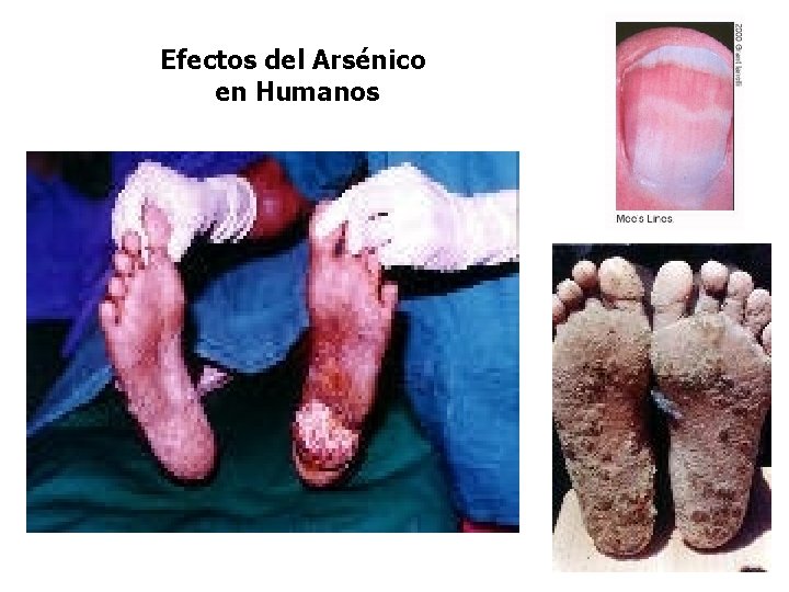 Efectos del Arsénico en Humanos 