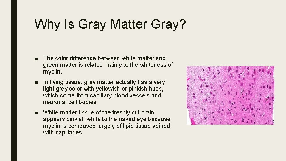 Why Is Gray Matter Gray? ■ The color difference between white matter and green