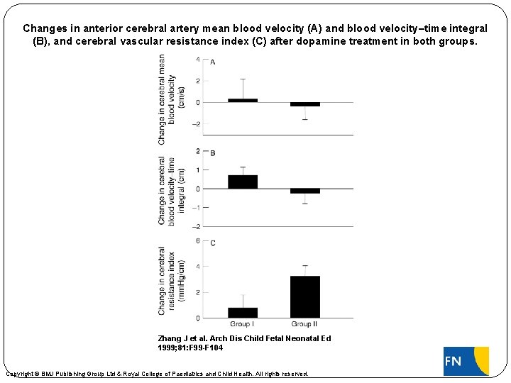 Changes in anterior cerebral artery mean blood velocity (A) and blood velocity–time integral (B),