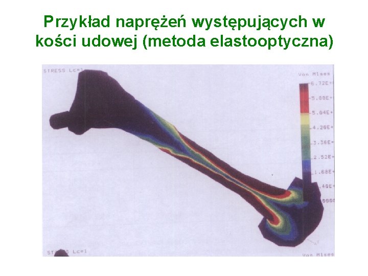 Przykład naprężeń występujących w kości udowej (metoda elastooptyczna) 