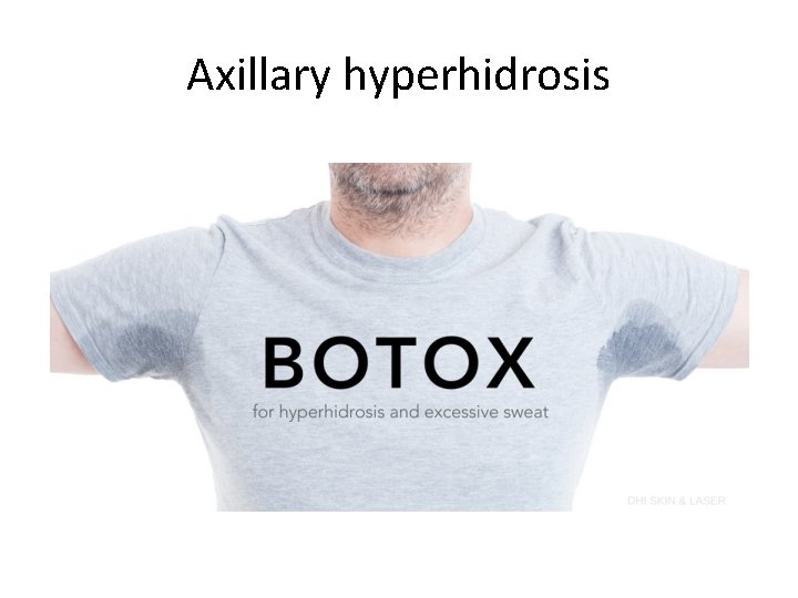 Axillary hyperhidrosis 
