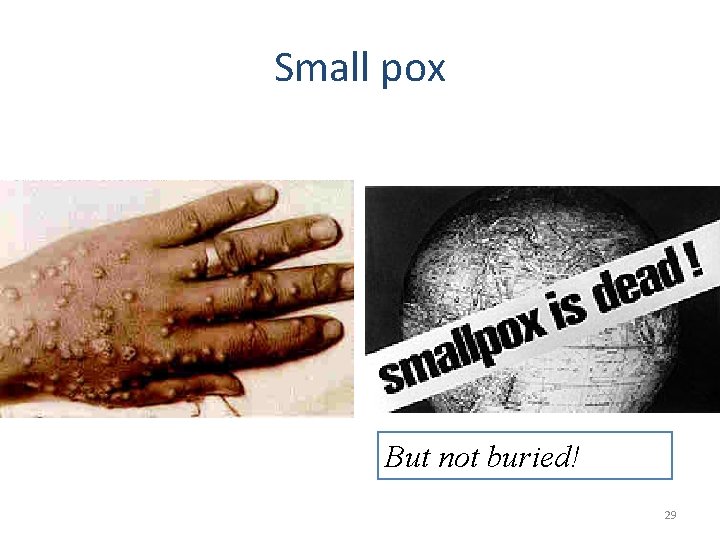 Small pox But not buried! 29 