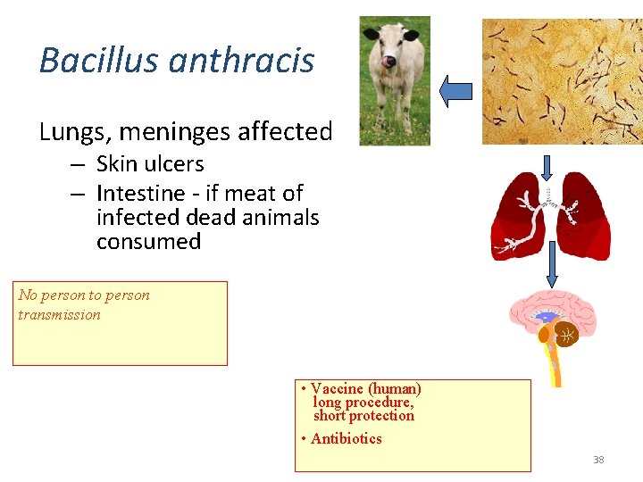 Bacillus anthracis Lungs, meninges affected – Skin ulcers – Intestine - if meat of