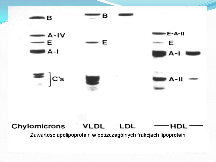 Zawartość apolipoprotein w poszczególnych frakcjach lipoprotein 
