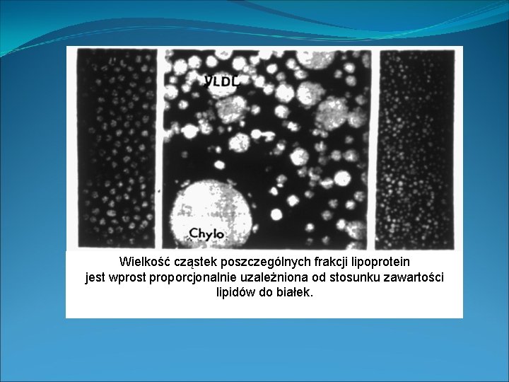 Wielkość cząstek poszczególnych frakcji lipoprotein jest wprost proporcjonalnie uzależniona od stosunku zawartości lipidów do