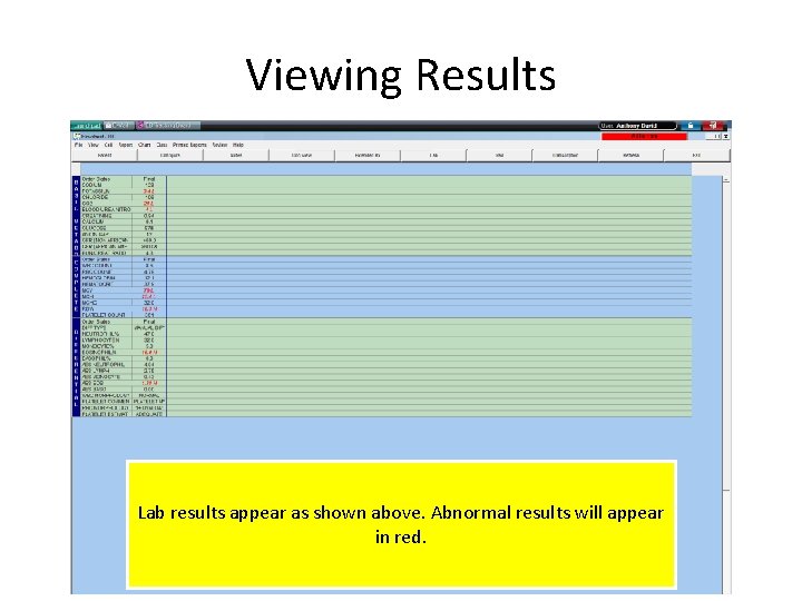 Viewing Results Lab results appear as shown above. Abnormal results will appear in red.