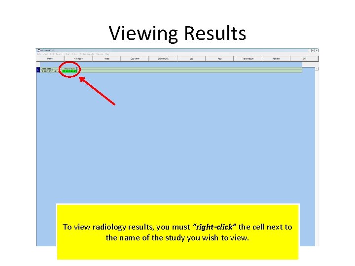 Viewing Results To view radiology results, you must “right-click” the cell next to the