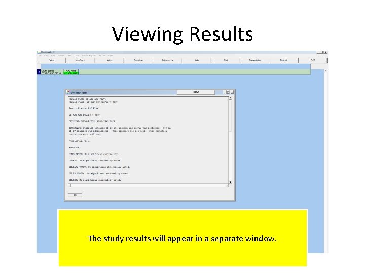 Viewing Results The study results will appear in a separate window. 