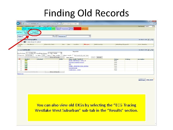 Finding Old Records You can also view old EKGs by selecting the “ECG Tracing