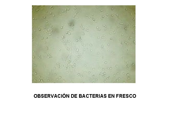 OBSERVACIÓN DE BACTERIAS EN FRESCO 