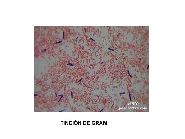 TINCIÓN DE GRAM 