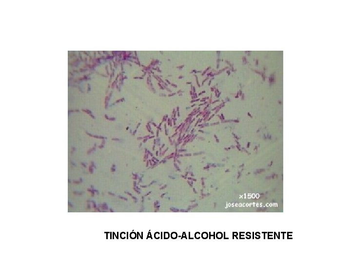 TINCIÓN ÁCIDO-ALCOHOL RESISTENTE 