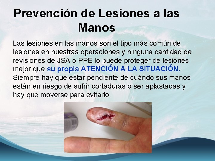 Prevención de Lesiones a las Manos Las lesiones en las manos son el tipo