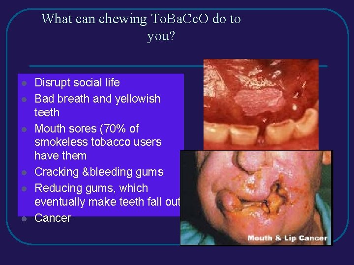 What can chewing To. Ba. Cc. O do to you? l l l Disrupt