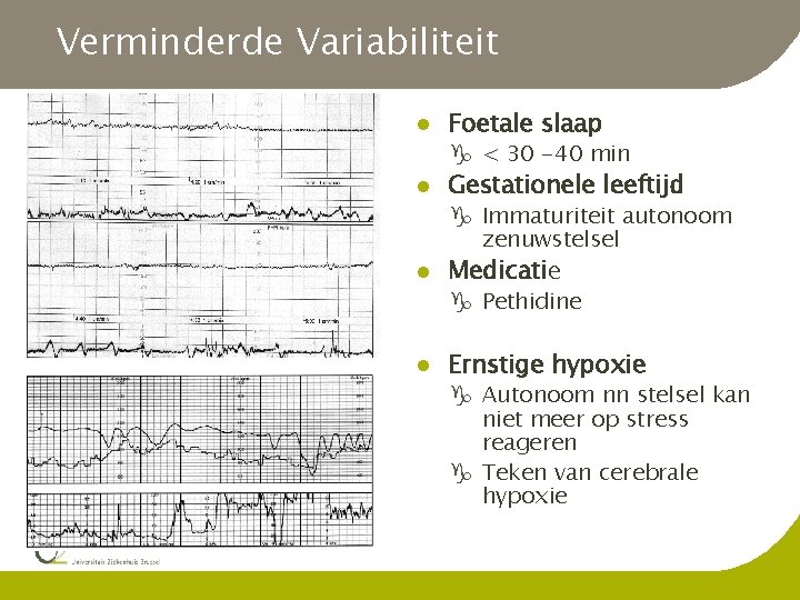 Verminderde Variabiliteit l Foetale slaap g < 30 -40 min l Gestationele leeftijd g