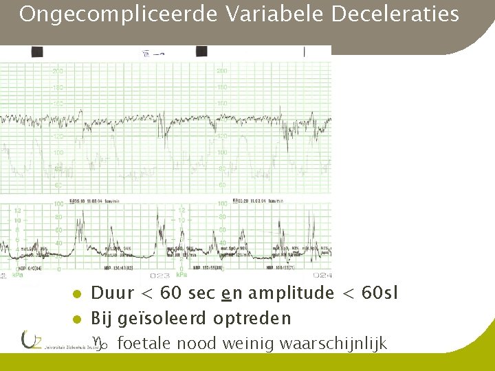 Ongecompliceerde Variabele Deceleraties l l Duur < 60 sec en amplitude < 60 sl