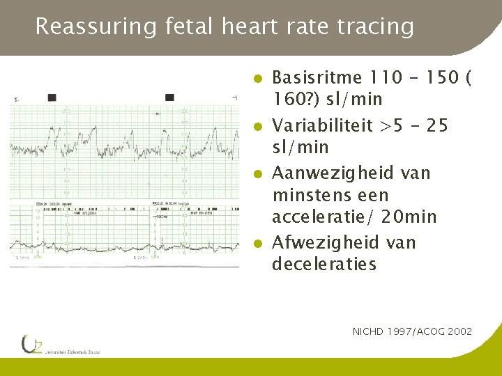 Reassuring fetal heart rate tracing l l Basisritme 110 - 150 ( 160? )