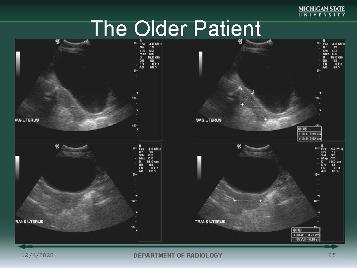 The Older Patient 12/4/2020 DEPARTMENT OF RADIOLOGY 25 